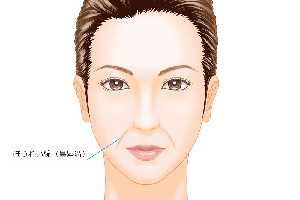 専門家が伝えるほうれい線の原因と消す方法 大塚美容整形塾 Dr 石井監修