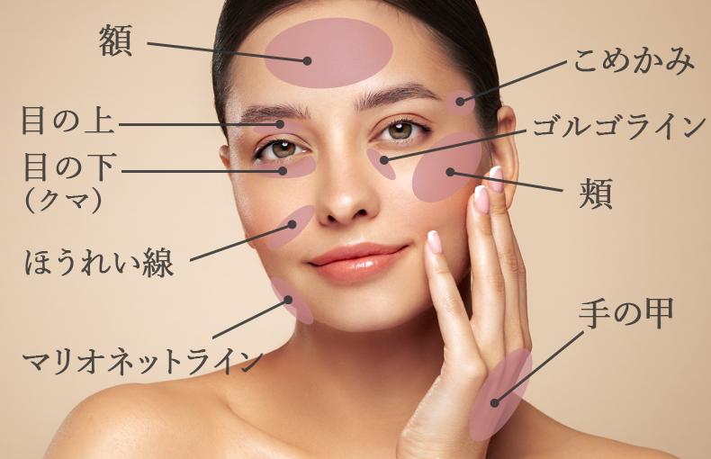 マフトガンによる脂肪注入適用部位