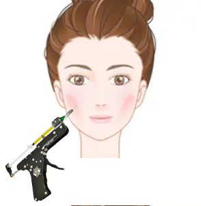 マフトガンによる脂肪注入