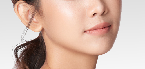 フェイスリフト