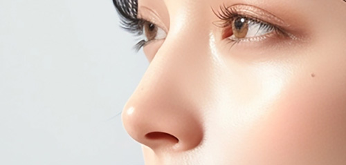 鼻の整形