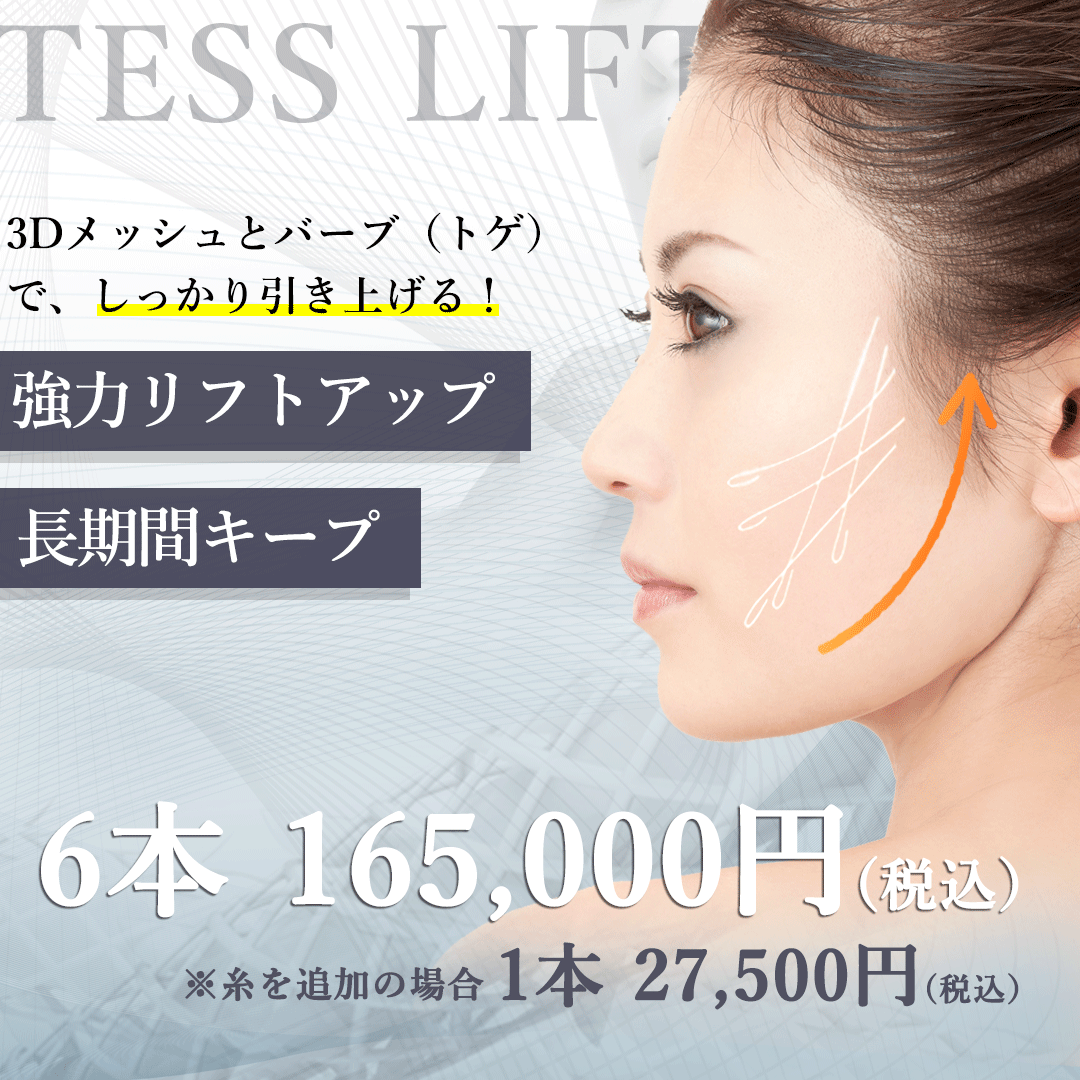 テスリフト（糸リフト）モニター募集　6本165,000円（税込）