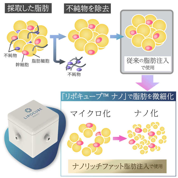 ナノリッチファットの生成方法