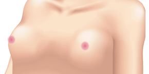 小さいバスト