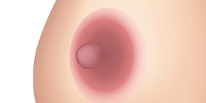 乳輪の悩み
