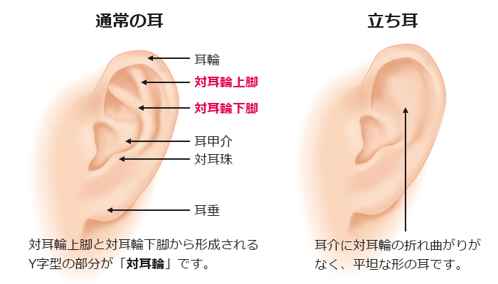 耳が正面を向いてしまう「立ち耳」