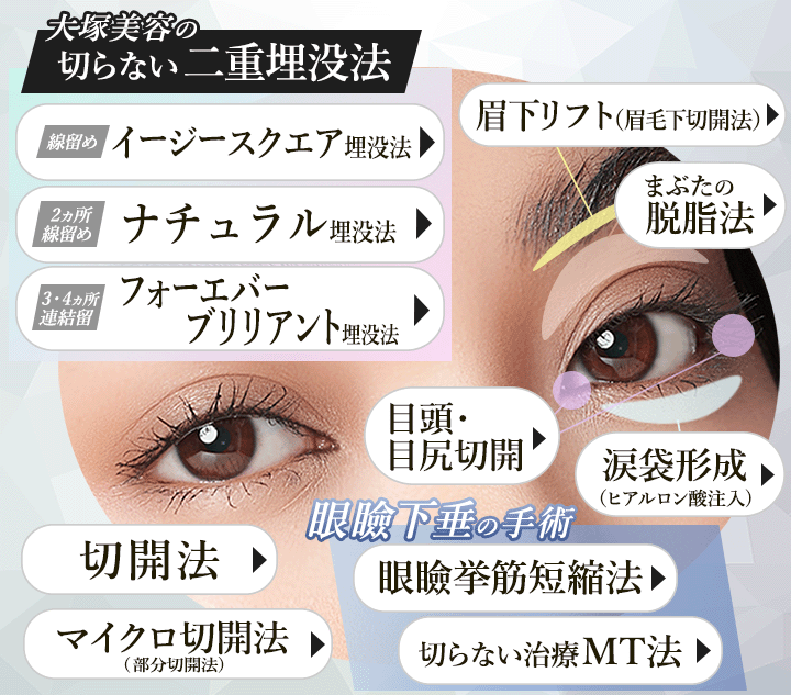オススメの目もと・二重まぶたのメニュー