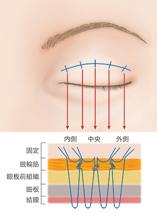 4 places connecting clasp