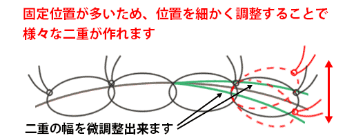 埋没法 4カ所連結法の概要