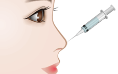 プロテーゼ隆鼻術の施術プロセス その2