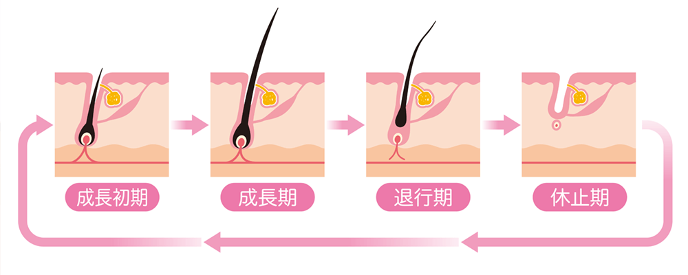 AGAのメカニズム