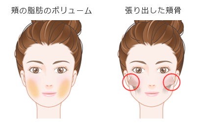 を 方法 落とす の 頬 肉 頬肉を落として顔痩せする方法7選！男性が小顔になるには?