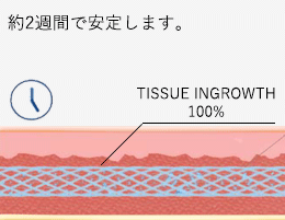 2週間で安定します