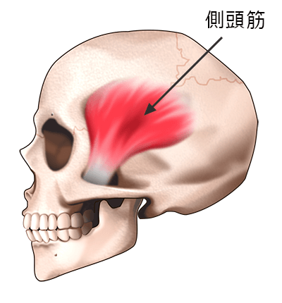 こめかみのへこみ・くぼみの原因