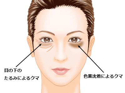 様々な理由でできるクマ