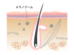 色素沈着が原因の｢茶クマ｣