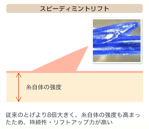 スピーディミントリフト