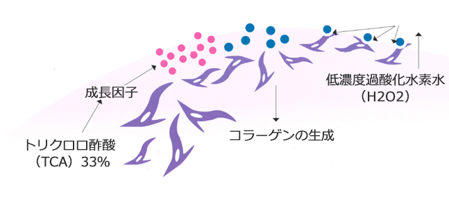 マッサージピール（PRX-T33）の含有成分