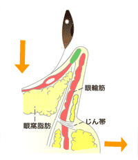 レディエッセ注入が最適な下まぶたのたるみについて