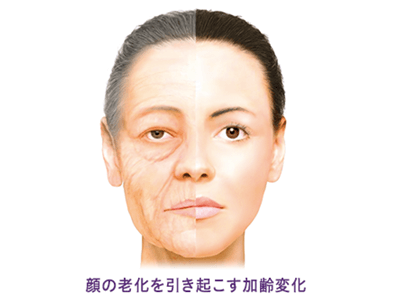 顔全体のバランスを考えて注入
