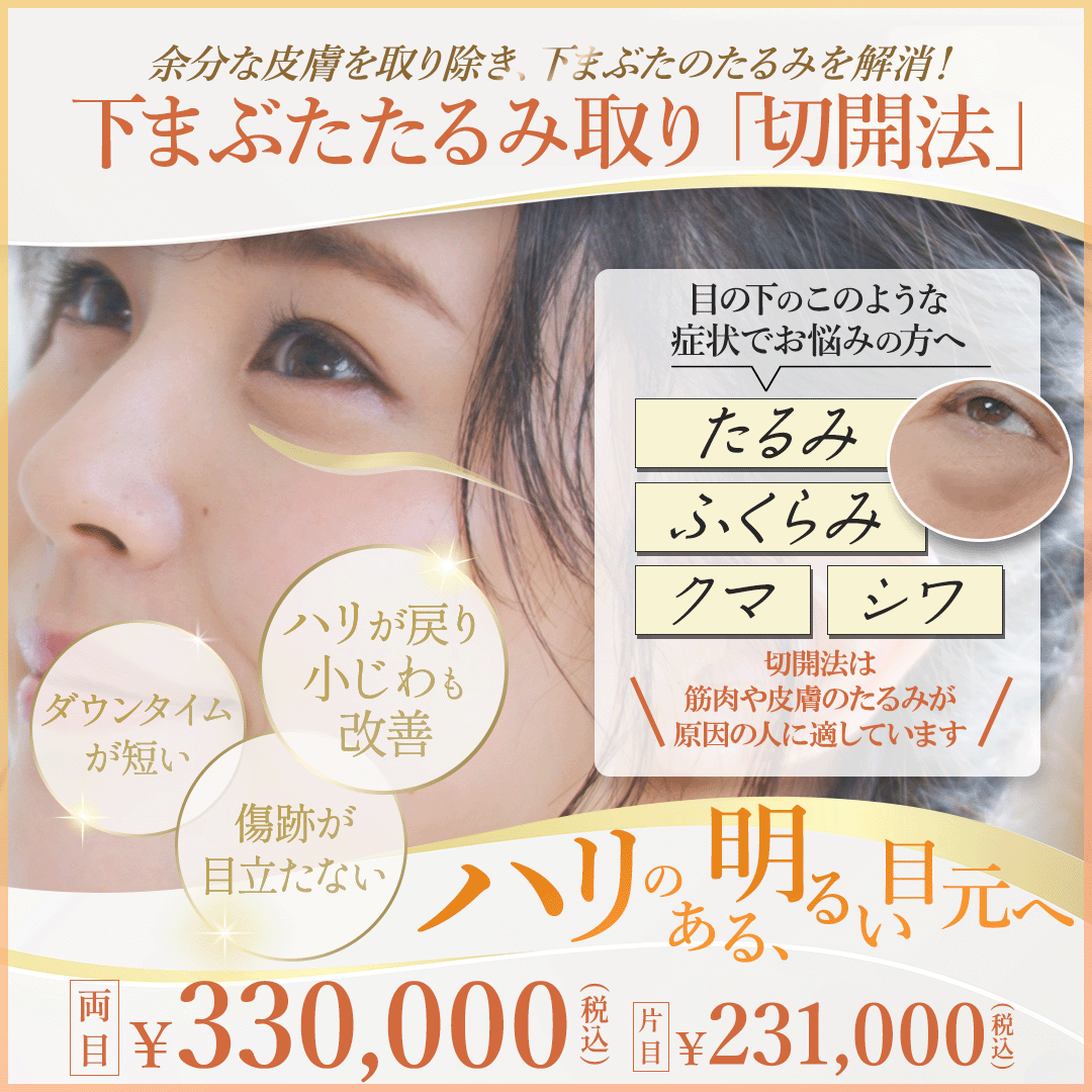 下まぶたたるみ取り（切開法）下まぶたのたるみ・目の下のクマ・目袋の改善