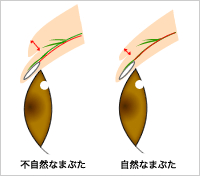 自然なまぶたと不自然なまぶた