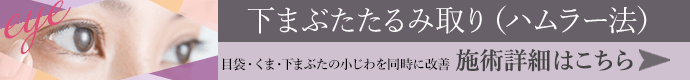 目袋・くま・下まぶたの小じわを同時に改善。下まぶたたるみ取り（ハムラ法） 施術詳細はこちら