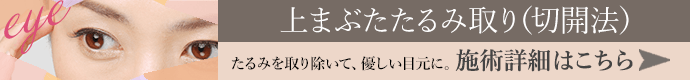 たるみと取りのぞいて、優しい目元へ。上まぶたたるみ取り（切開法） 施術詳細はこちら
