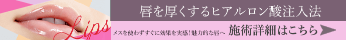 唇を厚くするヒアルロン酸注入法 施術詳細はこちら