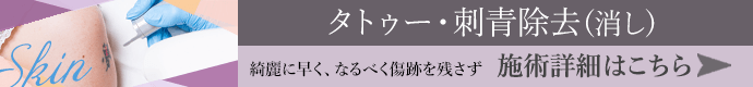 タトゥー・刺青除去（消し） 施術詳細はこちら