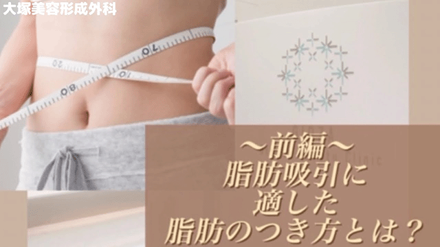 〜前編〜脂肪吸引に適した脂肪のつき方とは