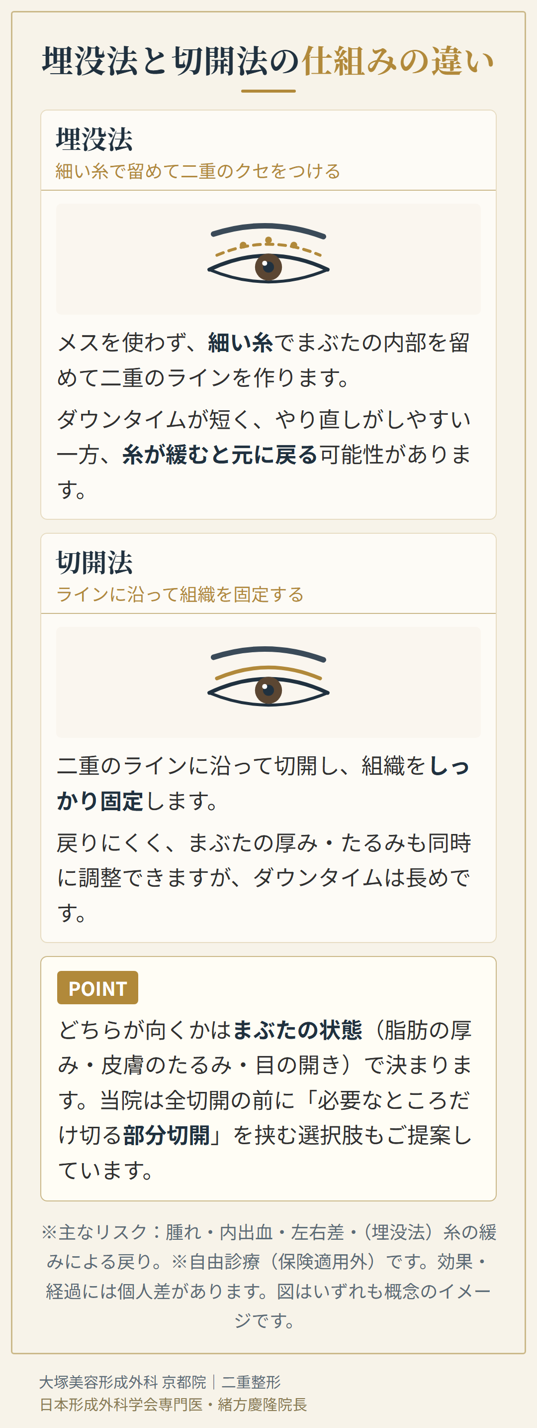 埋没法と切開法の仕組みの違いを表したまぶたの断面イラスト
