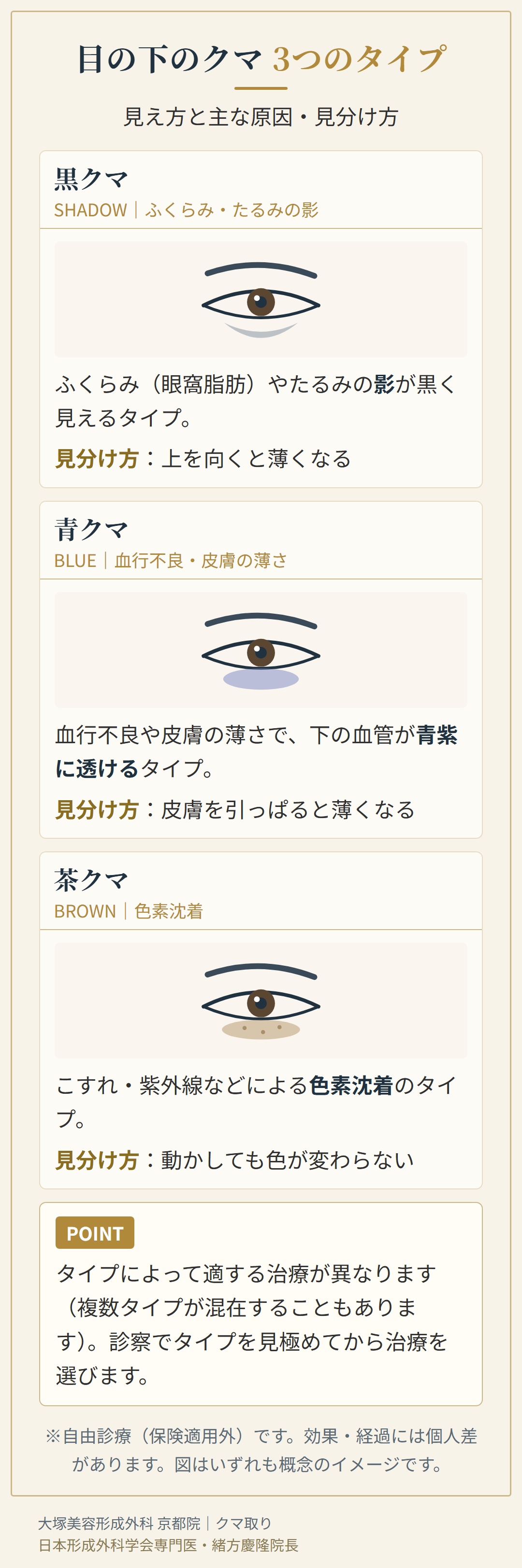 黒クマ・青クマ・茶クマの見た目の違いを表した目元のイラスト