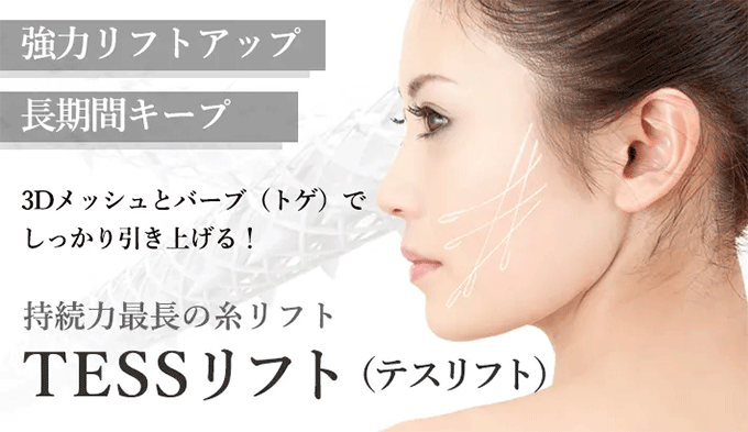 テスリフト