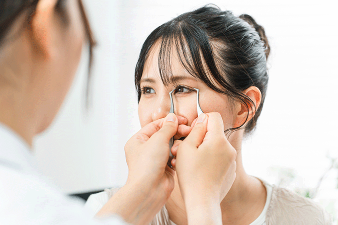 二重幅を狭くする治療は難易度が高い