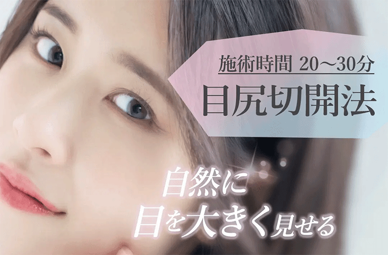 目尻切開が向いている人の特徴