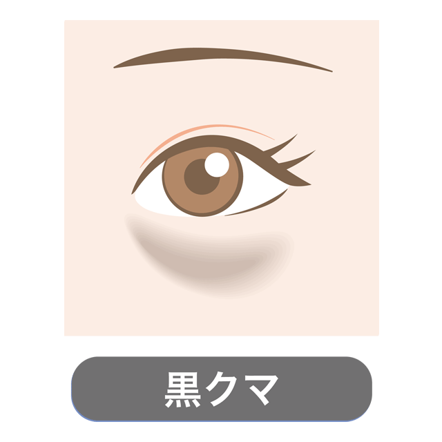 ｢黒クマ｣の原因と対処法