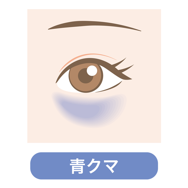 ｢青クマ｣の原因と対処法