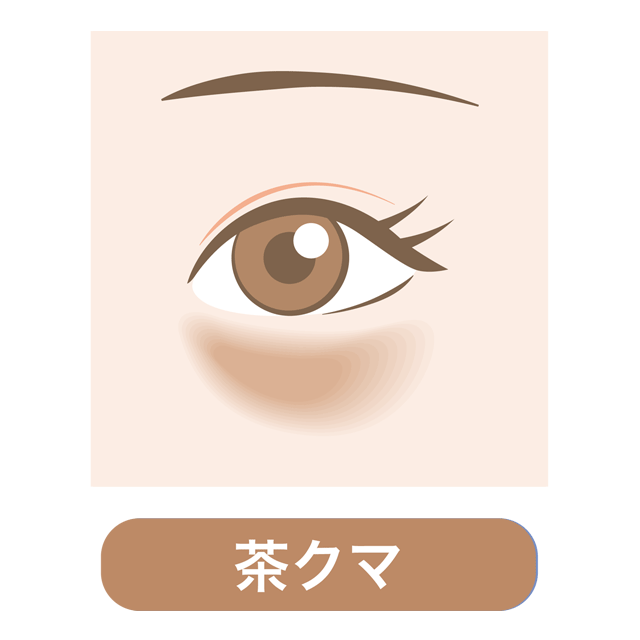 ｢茶クマ｣の原因と対処法